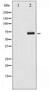 CDC25A Antibody - Western blot of CDC25A phosphorylation expression in UV treated 293 whole cell lysates,The lane on the left is treated with the antigen-specific peptide.