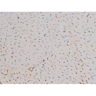 CDC25A Antibody - 1:200 staining mouse heart tissue by IHC-P. The tissue was formaldehyde fixed and a heat mediated antigen retrieval step in citrate buffer was performed. The tissue was then blocked and incubated with the antibody for 1.5 hours at 22°C. An HRP conjugated goat anti-rabbit antibody was used as the secondary.