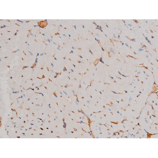 CDC25A Antibody - 1:200 staining mouse heart tissue by IHC-P. The tissue was formaldehyde fixed and a heat mediated antigen retrieval step in citrate buffer was performed. The tissue was then blocked and incubated with the antibody for 1.5 hours at 22°C. An HRP conjugated goat anti-rabbit antibody was used as the secondary.