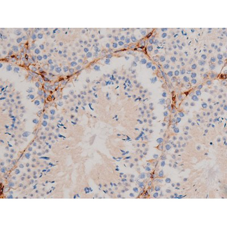 CDC25A Antibody - 1:200 staining mouse testis tissue by IHC-P. The tissue was formaldehyde fixed and a heat mediated antigen retrieval step in citrate buffer was performed. The tissue was then blocked and incubated with the antibody for 1.5 hours at 22°C. An HRP conjugated goat anti-rabbit antibody was used as the secondary.