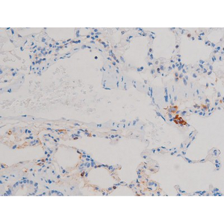 CDC25A Antibody - 1:200 staining rat lung tissue by IHC-P. The tissue was formaldehyde fixed and a heat mediated antigen retrieval step in citrate buffer was performed. The tissue was then blocked and incubated with the antibody for 1.5 hours at 22°C. An HRP conjugated goat anti-rabbit antibody was used as the secondary.