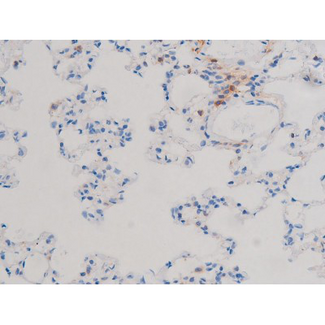 CDC25A Antibody - 1:200 staining rat lung tissue by IHC-P. The tissue was formaldehyde fixed and a heat mediated antigen retrieval step in citrate buffer was performed. The tissue was then blocked and incubated with the antibody for 1.5 hours at 22°C. An HRP conjugated goat anti-rabbit antibody was used as the secondary.