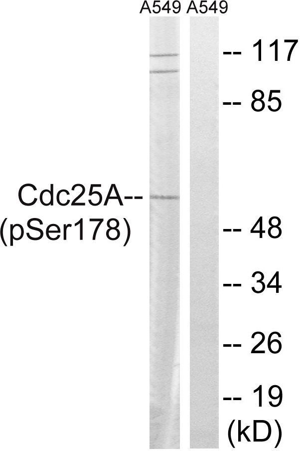 CDC25A Antibody - Western blot analysis of lysates from A549 cells treated with UV 15', using CDC25A (Phospho-Ser178) Antibody. The lane on the right is blocked with the phospho peptide.