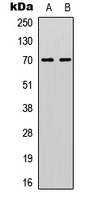 CDC25A Antibody - Western blot analysis of CDC25A (pS178) expression in HEK293T UV-treated (A); HeLa UV-treated (B) whole cell lysates.