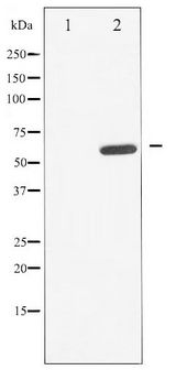CDC25A Antibody - Western blot of CDC25A phosphorylation expression in UV treated A549 whole cell lysates,The lane on the left is treated with the antigen-specific peptide.