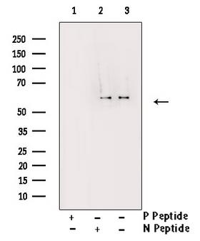 CDC25A Antibody - Western blot analysis of Phospho-CDC25A (Ser178) antibody expression in UV treated A549 cells lysates. The lane on the right is treated with the antigen-specific peptide.