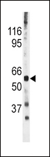 CDC25A Antibody - The anti-Phospho-CDC25A-S278 antibody is used in Western blot to detect Phospho-CDC25A-S278 in mouse heart tissue lysate