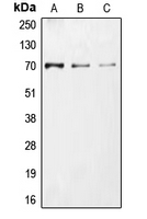 CDC25A Antibody - Western blot analysis of CDC25A (pS75) expression in HEK293T UV-treated (A); Jurkat UV-treated (B); NIH3T3 (C) whole cell lysates.