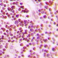 CDC25A Antibody - Immunohistochemical analysis of CDC25A (pS75) staining in human tonsil formalin fixed paraffin embedded tissue section. The section was pre-treated using heat mediated antigen retrieval with sodium citrate buffer (pH 6.0). The section was then incubated with the antibody at room temperature and detected using an HRP conjugated compact polymer system. DAB was used as the chromogen. The section was then counterstained with hematoxylin and mounted with DPX.