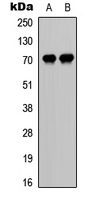 CDC25A Antibody - Western blot analysis of CDC25A (pS75) expression in HeLa UV-treated (A); mouse liver (B) whole cell lysates.