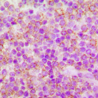 CDC25A Antibody - Immunohistochemical analysis of CDC25A (pS75) staining in human tonsil formalin fixed paraffin embedded tissue section. The section was pre-treated using heat mediated antigen retrieval with sodium citrate buffer (pH 6.0). The section was then incubated with the antibody at room temperature and detected using an HRP conjugated compact polymer system. DAB was used as the chromogen. The section was then counterstained with hematoxylin and mounted with DPX. w