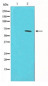 CDC25A Antibody - Western blot of HeLa cell lysate using Phospho-CDC25A(Ser75) Antibody