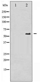 CDC25A Antibody - Western blot of CDC25A phosphorylation expression in UV treated A2780 whole cell lysates,The lane on the left is treated with the antigen-specific peptide.