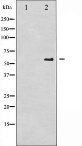CDC25A Antibody - Western blot analysis of CDC25A phosphorylation expression in UV treated A2780 whole cells lysates. The lane on the left is treated with the antigen-specific peptide.
