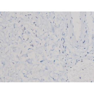 CDC25A Antibody - 1:200 staining human esophagus tissue by IHC-P. The tissue was formaldehyde fixed and a heat mediated antigen retrieval step in citrate buffer was performed. The tissue was then blocked and incubated with the antibody for 1.5 hours at 22°C. An HRP conjugated goat anti-rabbit antibody was used as the secondary.