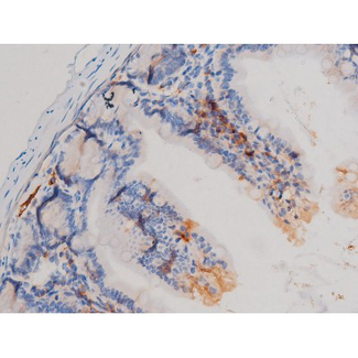 CDC25A Antibody - 1:200 staining mouse intestinal tissue by IHC-P. The tissue was formaldehyde fixed and a heat mediated antigen retrieval step in citrate buffer was performed. The tissue was then blocked and incubated with the antibody for 1.5 hours at 22°C. An HRP conjugated goat anti-rabbit antibody was used as the secondary.