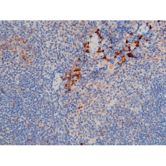 CDC25A Antibody - 1:200 staining mouse spleen tissue by IHC-P. The tissue was formaldehyde fixed and a heat mediated antigen retrieval step in citrate buffer was performed. The tissue was then blocked and incubated with the antibody for 1.5 hours at 22°C. An HRP conjugated goat anti-rabbit antibody was used as the secondary.