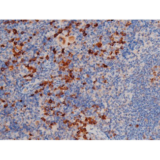 CDC25A Antibody - 1:200 staining mouse spleen tissue by IHC-P. The tissue was formaldehyde fixed and a heat mediated antigen retrieval step in citrate buffer was performed. The tissue was then blocked and incubated with the antibody for 1.5 hours at 22°C. An HRP conjugated goat anti-rabbit antibody was used as the secondary.