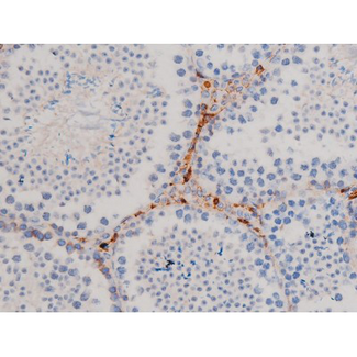 CDC25A Antibody - 1:200 staining mouse testis tissue by IHC-P. The tissue was formaldehyde fixed and a heat mediated antigen retrieval step in citrate buffer was performed. The tissue was then blocked and incubated with the antibody for 1.5 hours at 22°C. An HRP conjugated goat anti-rabbit antibody was used as the secondary.