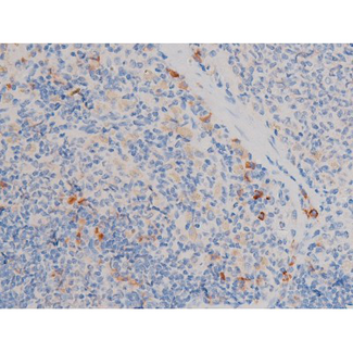 CDC25A Antibody - 1:200 staining rat spleen tissue by IHC-P. The tissue was formaldehyde fixed and a heat mediated antigen retrieval step in citrate buffer was performed. The tissue was then blocked and incubated with the antibody for 1.5 hours at 22°C. An HRP conjugated goat anti-rabbit antibody was used as the secondary.