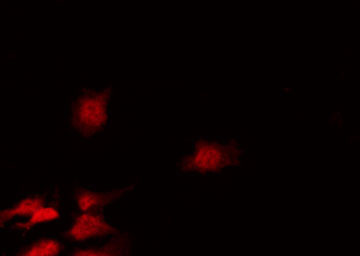 CDC25A Antibody - Staining HeLa cells by IF/ICC. The samples were fixed with PFA and permeabilized in 0.1% Triton X-100, then blocked in 10% serum for 45 min at 25°C. The primary antibody was diluted at 1:200 and incubated with the sample for 1 hour at 37°C. An Alexa Fluor 594 conjugated goat anti-rabbit IgG (H+L) Ab, diluted at 1/600, was used as the secondary antibody.