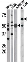 CDC25A Antibody - The anti-Phospho-CDC25A-S75 antibody is used in Western blot to detect Phospho-CDC25A-S75 in, form left to right, HeLa, HL60, mouse kidney, and mouse liver tissue lysates.