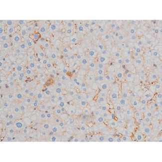 CDC25A Antibody - 1:200 staining rat liver tissue by IHC-P. The tissue was formaldehyde fixed and a heat mediated antigen retrieval step in citrate buffer was performed. The tissue was then blocked and incubated with the antibody for 1.5 hours at 22°C. An HRP conjugated goat anti-rabbit antibody was used as the secondary.
