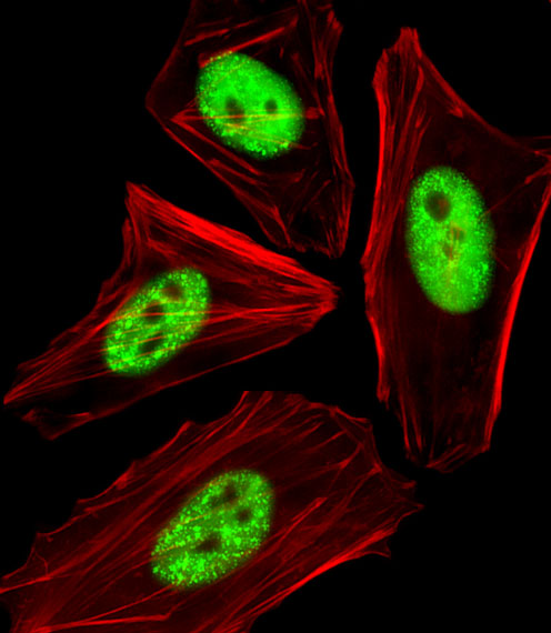 CDC25A Antibody - Fluorescent image of HeLa cells stained with Phospho-CDC25A(T507) Antibody. Antibody was diluted at 1:25 dilution. An Alexa Fluor 488-conjugated goat anti-rabbit lgG at 1:400 dilution was used as the secondary antibody (green). Cytoplasmic actin was counterstained with Alexa Fluor 555 conjugated with Phalloidin (red).