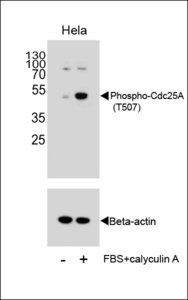 CDC25A Antibody - Western blot of extracts from HeLa cells, untreated or treated with calyculin A, using Phospho-Cdc25A Antibody (T507).