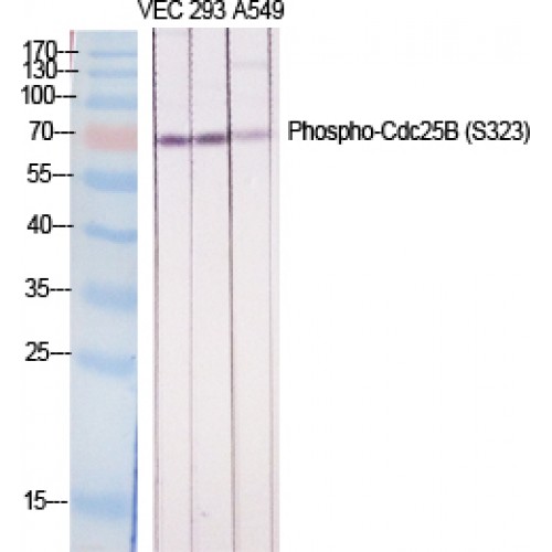 CDC25B Antibody - Western blot of Phospho-Cdc25B (S323) antibody