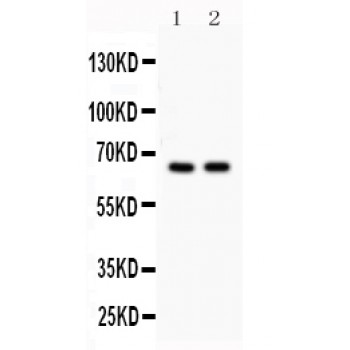 CDC25B Antibody - Cdc25B antibody Western blot. All lanes: Anti Cdc25B at 0.5 ug/ml. Lane 1: Rat Liver Tissue Lysate at 50 ug. Lane 2: Rat Testis Tissue Lysate at 50 ug. Predicted band size: 65 kD. Observed band size: 65 kD.