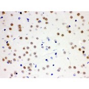 CDC25B Antibody - Cdc25B antibody IHC-paraffin. IHC(P): Mouse Brain Tissue.
