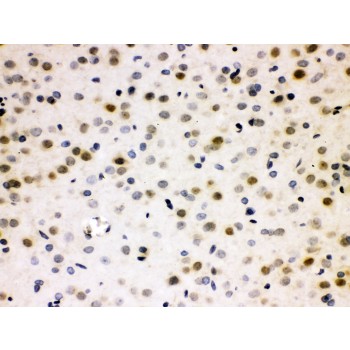 CDC25B Antibody - Cdc25B antibody IHC-paraffin. IHC(P): Rat Brain Tissue.