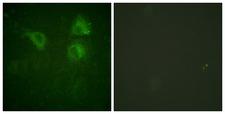 CDC25B Antibody - Immunofluorescence analysis of HUVEC cells, using CDC25B Antibody. The picture on the right is blocked with the synthesized peptide.