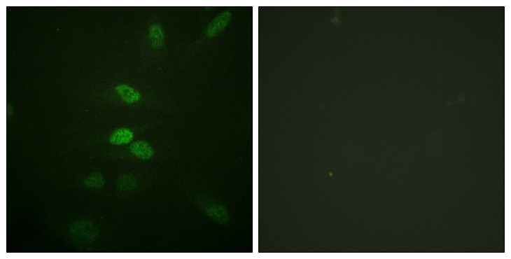 CDC25B Antibody - Immunofluorescence analysis of HeLa cells, using CDC25B Antibody. The picture on the right is blocked with the synthesized peptide.