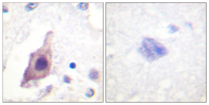 CDC25B Antibody - Immunohistochemistry analysis of paraffin-embedded human brain tissue, using CDC25B Antibody. The picture on the right is blocked with the synthesized peptide.