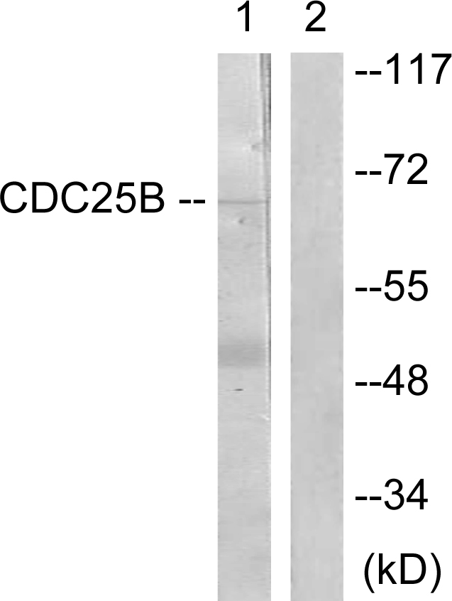 CDC25B Antibody - Western blot analysis of lysates from Raw264.7 cells, treated with UV 15', using CDC25B Antibody. The lane on the right is blocked with the synthesized peptide.