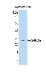 CDC25B Antibody - Western blot of recombinant CDC25B.  This image was taken for the unconjugated form of this product. Other forms have not been tested.