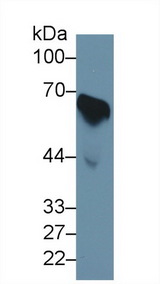 CDC25B Antibody - Western Blot; Sample: Human Serum; Primary Ab: 1µg/ml Rabbit Anti-Human CDC25B Antibody Second Ab: 0.2µg/mL HRP-Linked Caprine Anti-Rabbit IgG Polyclonal Antibody
