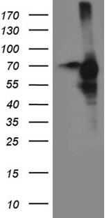 CDC25B Antibody - HEK293T cells were transfected with the pCMV6-ENTRY control. (Left lane) or pCMV6-ENTRY CDC25B. (Right lane) cDNA for 48 hrs and lysed. Equivalent amounts of cell lysates. (5 ug per lane) were separated by SDS-PAGE and immunoblotted with anti-CDC25B. (1:2000)