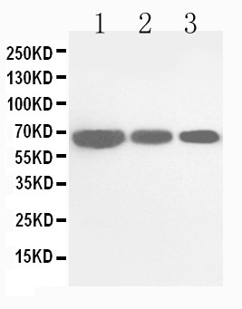 CDC25B Antibody - WB of CDC25B antibody. All lanes: Anti-CDC25B at 0.5ug/ml. Lane 1: Rat Brain Tissue Lysate at 40ug. Lane 2: Rat Kidney Tissue Lysate at 40ug. Lane 3: Rat Lung Tissue Lysate at 40ug. Predicted bind size: 65KD. Observed bind size: 65KD.