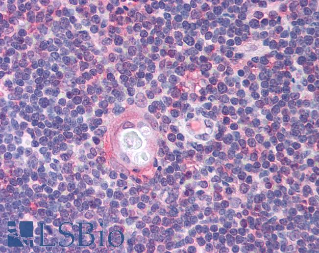 CDC25B Antibody - Anti-CDC25B antibody IHC of human thymus. Immunohistochemistry of formalin-fixed, paraffin-embedded tissue after heat-induced antigen retrieval. Antibody concentration 5 ug/ml.  This image was taken for the unconjugated form of this product. Other forms have not been tested.