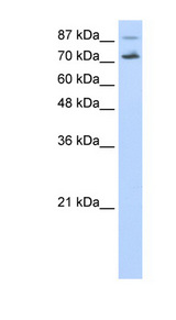 CDC25B Antibody - CDC25B antibody Western blot of HepG2 cell lysate. This image was taken for the unconjugated form of this product. Other forms have not been tested.
