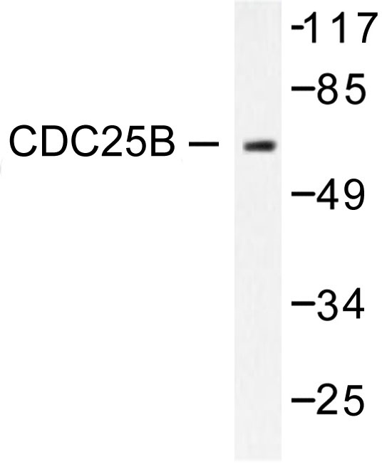 CDC25B Antibody - Western blot of CDC25B (R317) pAb in extracts from RAW264.7 cells.