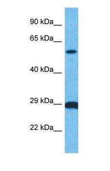 CDC25B Antibody - Western blot of MPIP2 Antibody with human MDA-MB-435s Whole Cell lysate.  This image was taken for the unconjugated form of this product. Other forms have not been tested.