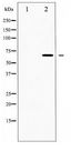 CDC25B Antibody - Western blot of CDC25B expression in RAW264.7 whole cell lysates,The lane on the left is treated with the antigen-specific peptide.