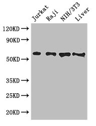 CDC25B Antibody - Positive WB detected in:Jurkat whole cell lysate,Raji whole cell lysate,NIH/3T3 whole cell lysate,Mouse liver tissue;All lanes: CDC25B antibody at 3ug/ml;Secondary;Goat polyclonal to rabbit IgG at 1/50000 dilution;Predicted band size: 65,64,61,68 kDa;Observed band size: 65 kDa;