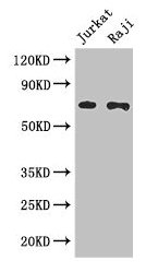 CDC25B Antibody - Western Blot Positive WB detected in: Jurkat whole cell lysate, Raji whole cell lysate All lanes: CDC25B antibody at 3µg/ml Secondary Goat polyclonal to rabbit IgG at 1/50000 dilution Predicted band size: 65, 64, 61, 68 kDa Observed band size: 65 kDa