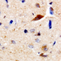 CDC25B Antibody - Immunohistochemical analysis of CDC25B staining in human brain formalin fixed paraffin embedded tissue section. The section was pre-treated using heat mediated antigen retrieval with sodium citrate buffer (pH 6.0). The section was then incubated with the antibody at room temperature and detected using an HRP conjugated compact polymer system. DAB was used as the chromogen. The section was then counterstained with haematoxylin and mounted with DPX.