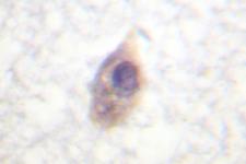 CDC25B Antibody - IHC of CDC25B (K349) pAb in paraffin-embedded human breast tissue.